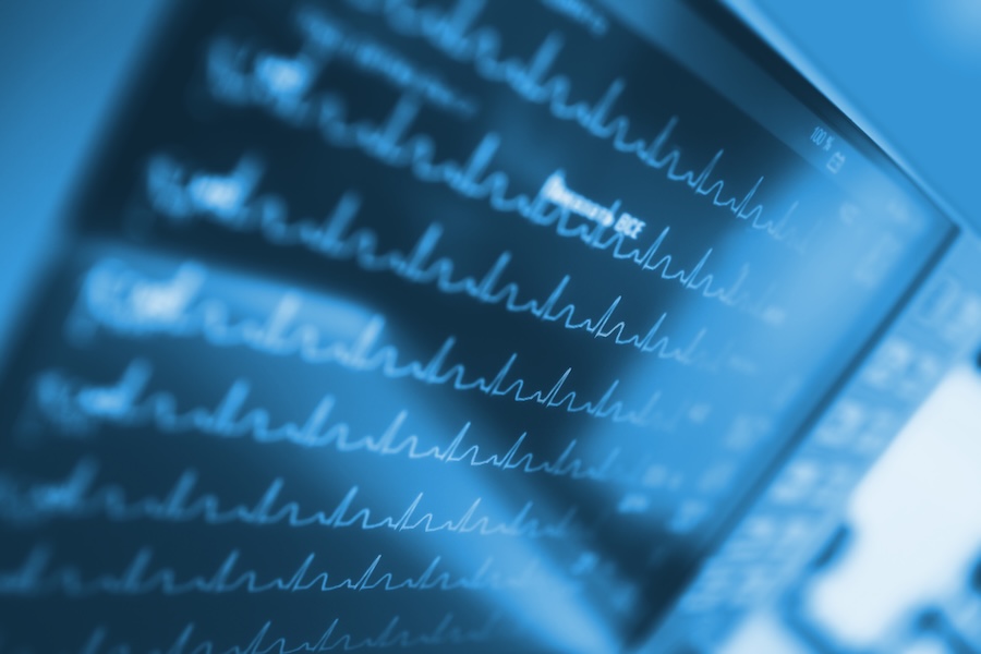 delayed ER treatment