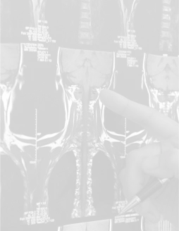 Brain and spinal injuries